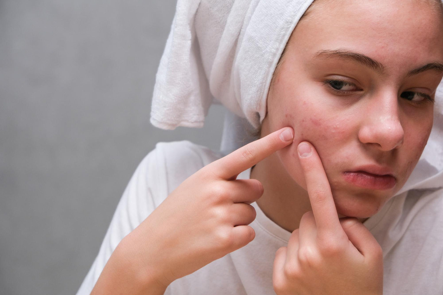 yplayz-blog-teen-skincare-routine-clears-acne
