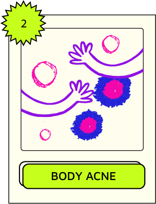 anti acne cream